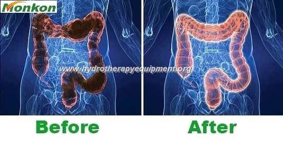 Hydrotherapy Equipment