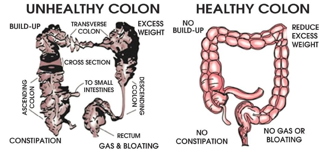 How Do I Clean Out My Colon?
