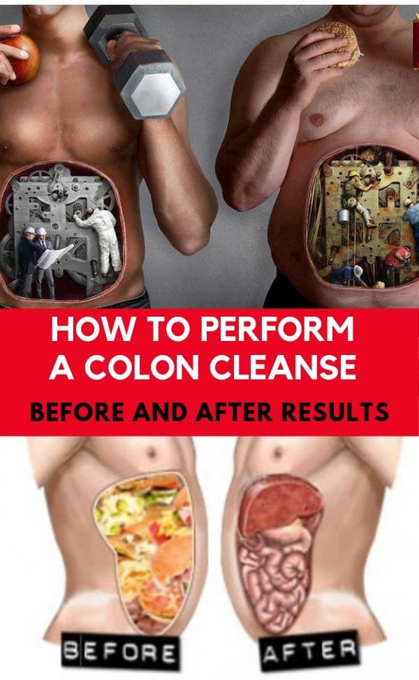 How Do You Get a Colonic?