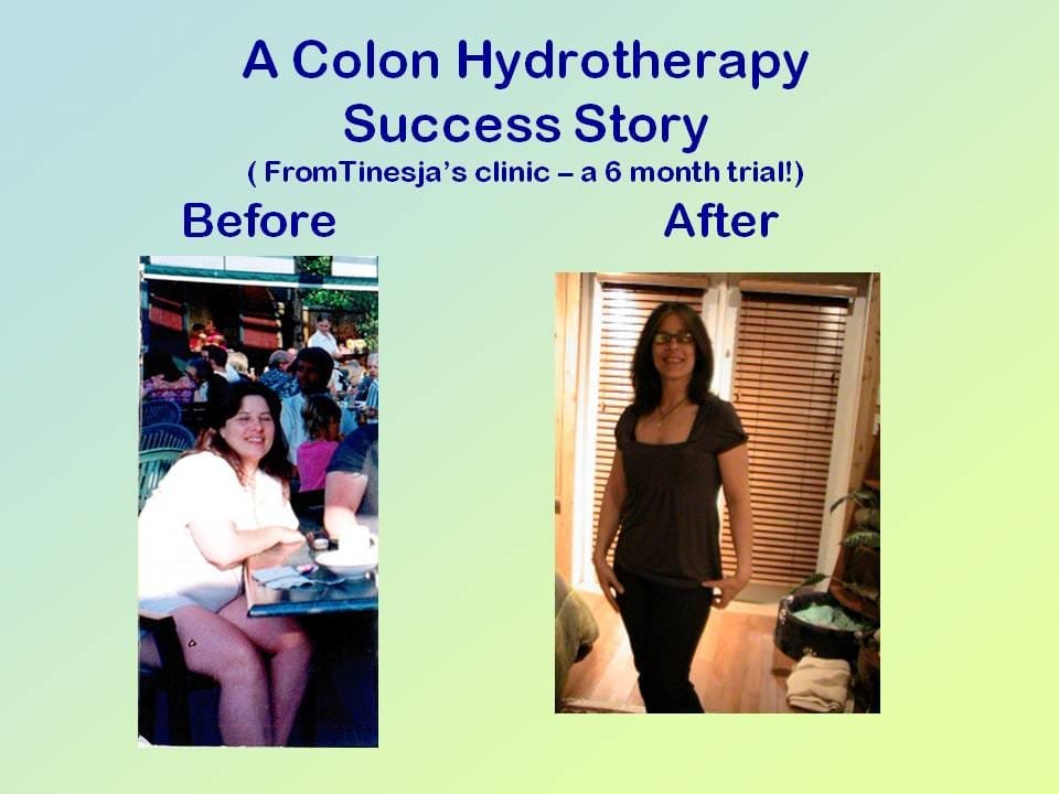 Purchasing Colon Hydrotherapy Equipment 109