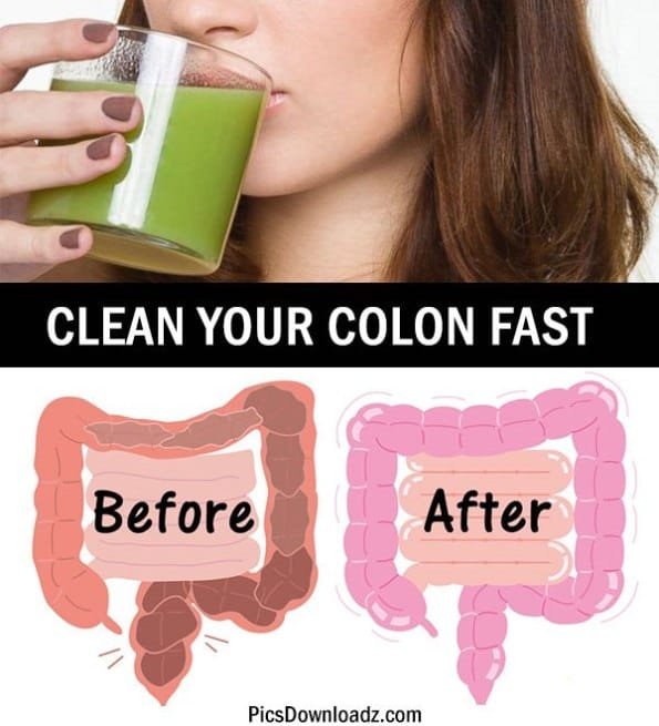 Purchasing Colon Hydrotherapy Equipment 113