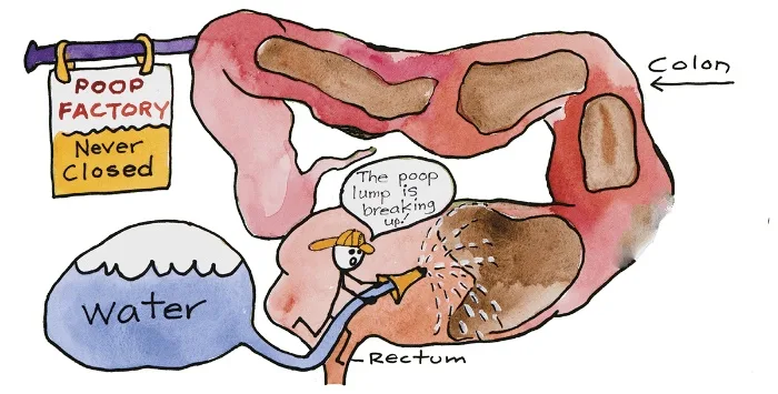 DIY Colonic Machine: Okrepite vaše dobro počutje doma