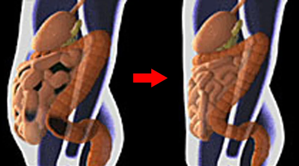 How Long Does It Take to Cleanse Your Colon?